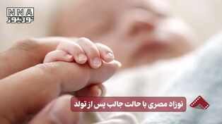 نورنما |نوزاد مصری با حالت جالب پس از تولد