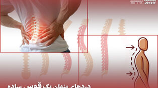 پادکست | دردهای پنهان یک قوس ساده