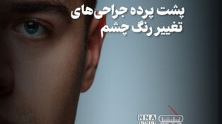 پادکست | پشت پرده جراحی های تغییر رنگ چشم