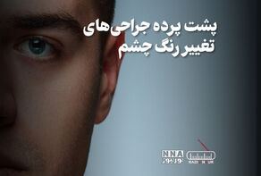 پادکست | پشت پرده جراحی های تغییر رنگ چشم