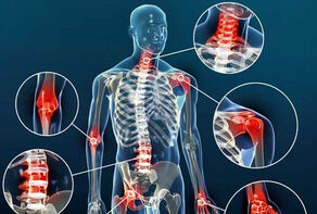 12روش برای جلوگیری ازپیشرفت آرتروز+ قوی‌ترین سلاح مقابله باآرتروز چیست؟