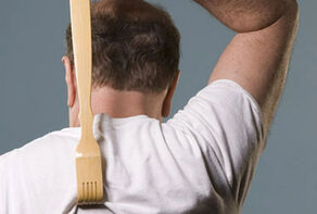 کشف کلید کنترل خارش در مغز انسان