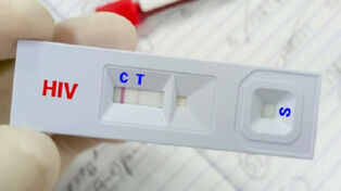 کاهش سهم «اعتیاد» در انتقال HIV؛ تغییر الگوی انتقال بیماری در ایران